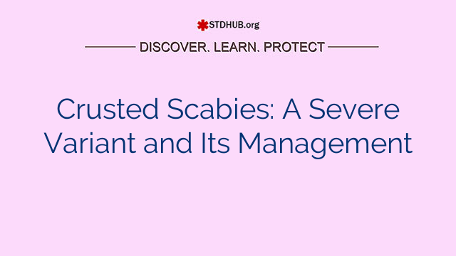 Crusted Scabies: A Severe Variant and Its Management